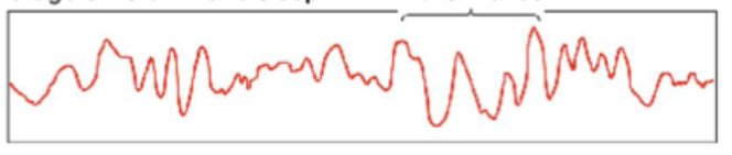 <ul><li><p>Delta waves</p></li><li><p>Deep sleep, slower frequency, and higher amplitude</p></li><li><p>Slow-wave sleep</p></li></ul><p></p>