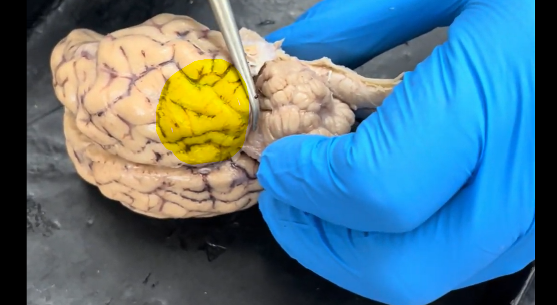 <p>Name the part of the brain at the tip of the probe and highlighted in yellow.</p>