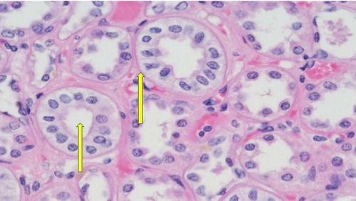<p>Location: Ducts of glands </p><p>Function: Absorption  </p>