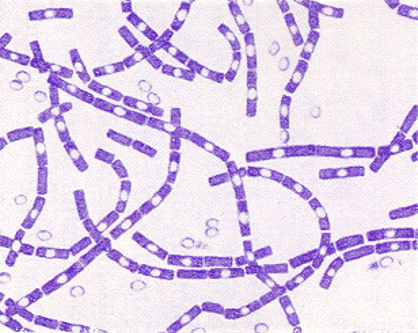 <p>waxy-looking, gram-positive bacillus, spores may be visible as poorly stained oval swellings, genera of decomposers</p>