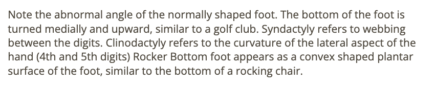 <p>b) club foot</p>