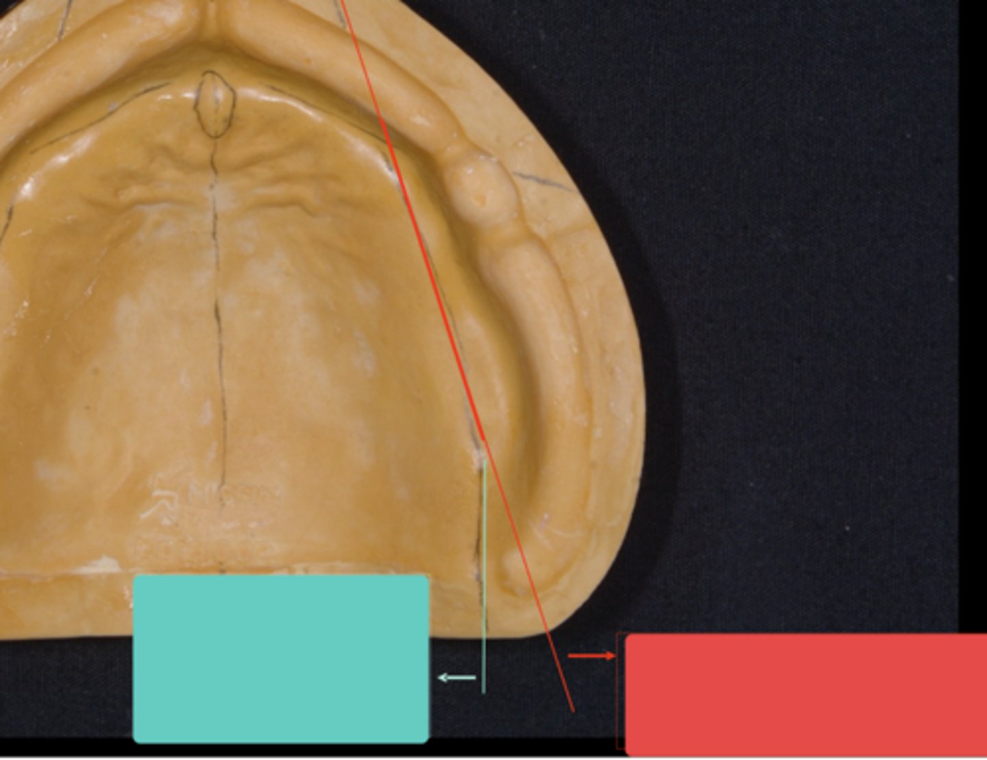 <p>Which line marks the center of the ridge?</p>