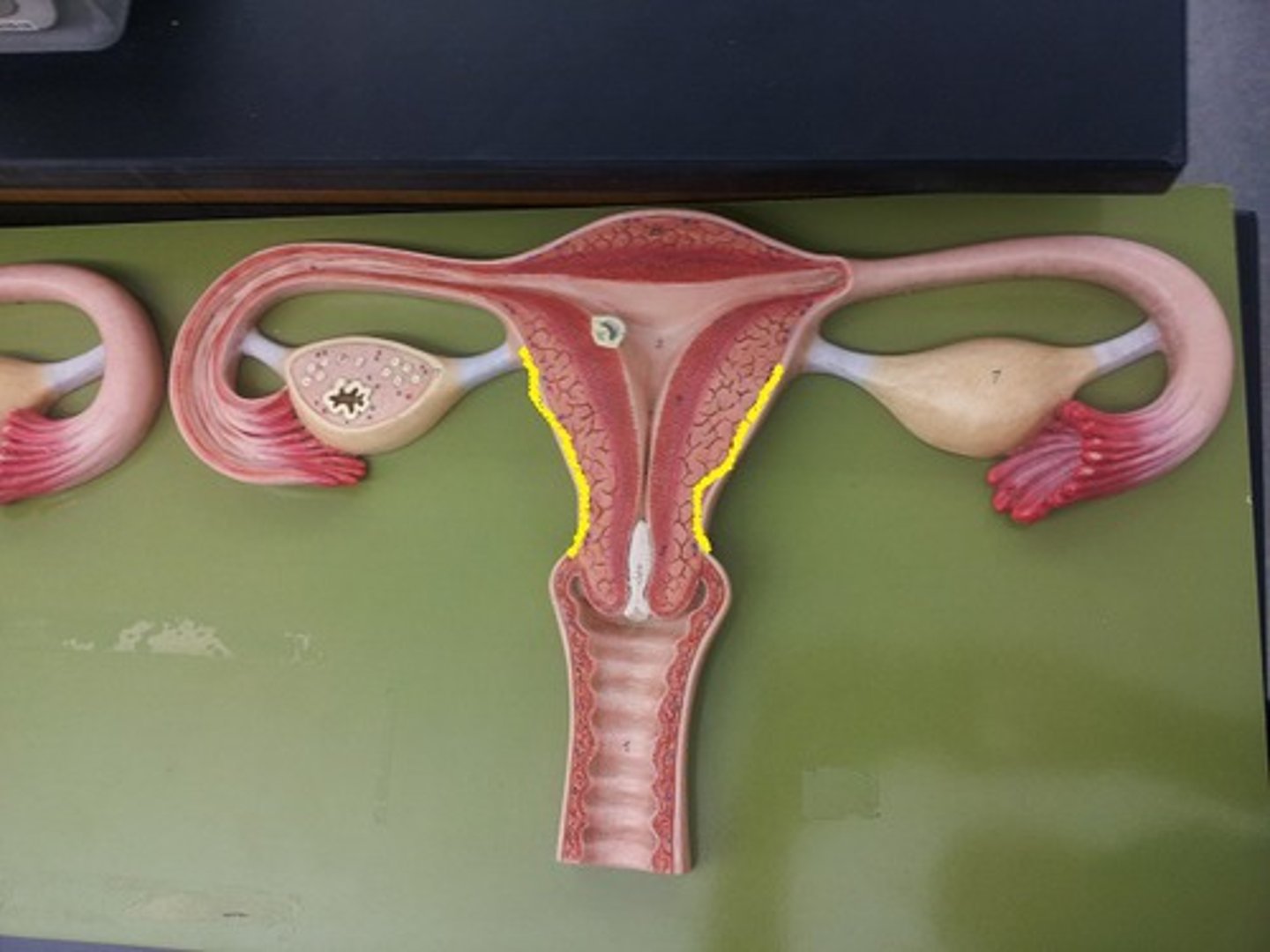 <p>outer layer of uterus</p>