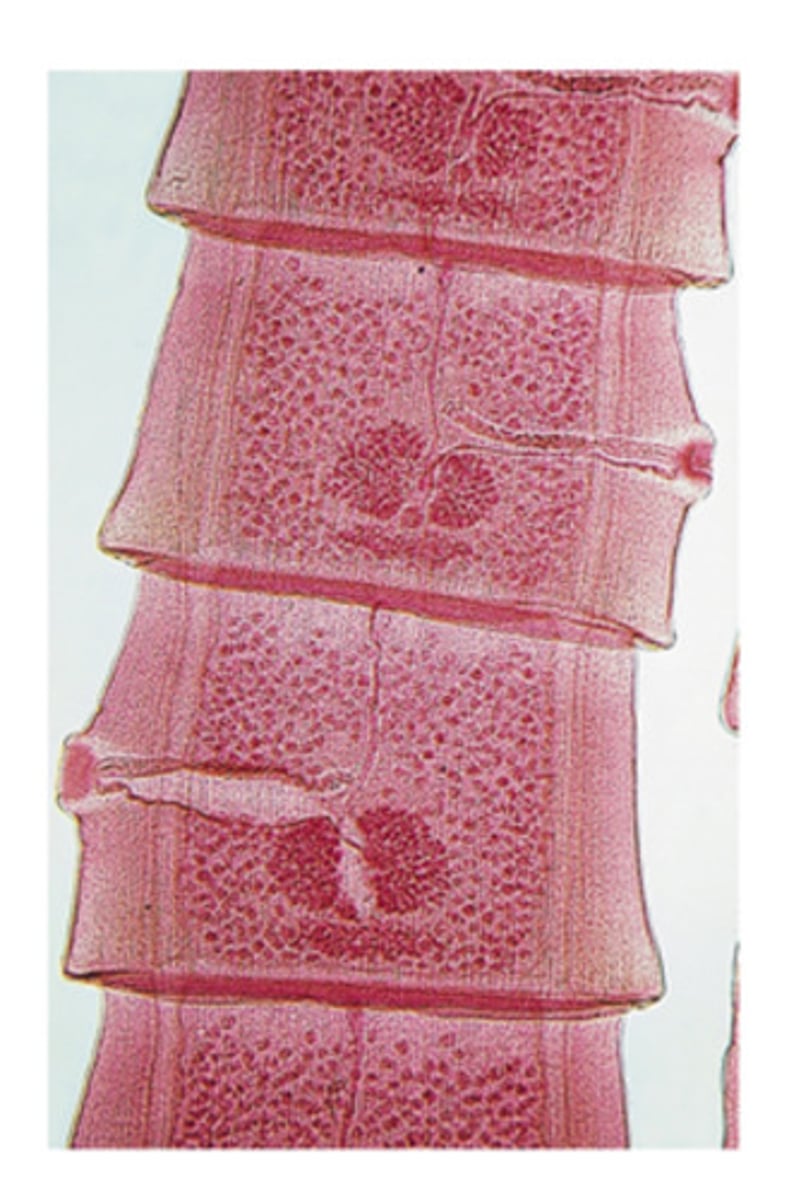 <p>Taenia species tapeworm mature proglottids have a distinctly different appearance from those dipylidium caninum. What is the difference</p>