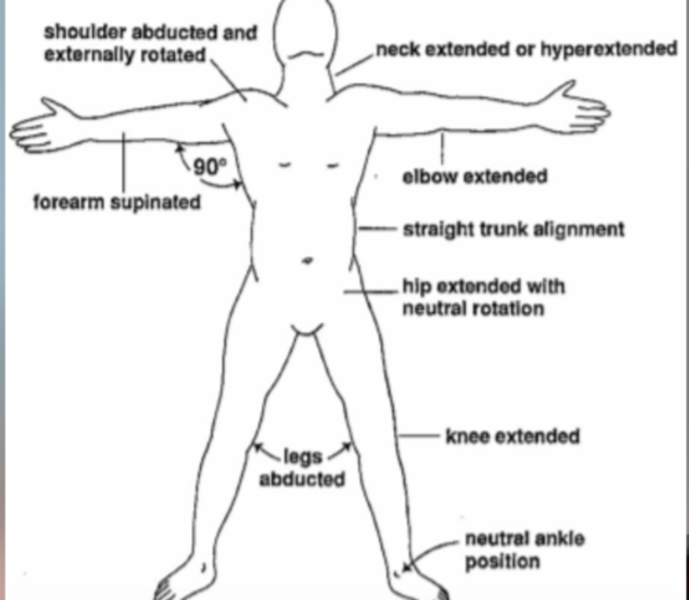 <p>Anterior neck: hyperextension with firm cervical brace</p><p>Shoulder: ABD and ER in airplane splint</p><p>Elbow: extension and supination</p><p>Hand: wrist ext, MCP flexion , IP extension brace; extension and ABD brace</p><p>Knee: extension, posterior knee splint</p><p>Ankle: DF spint or in neutral in AFO</p>