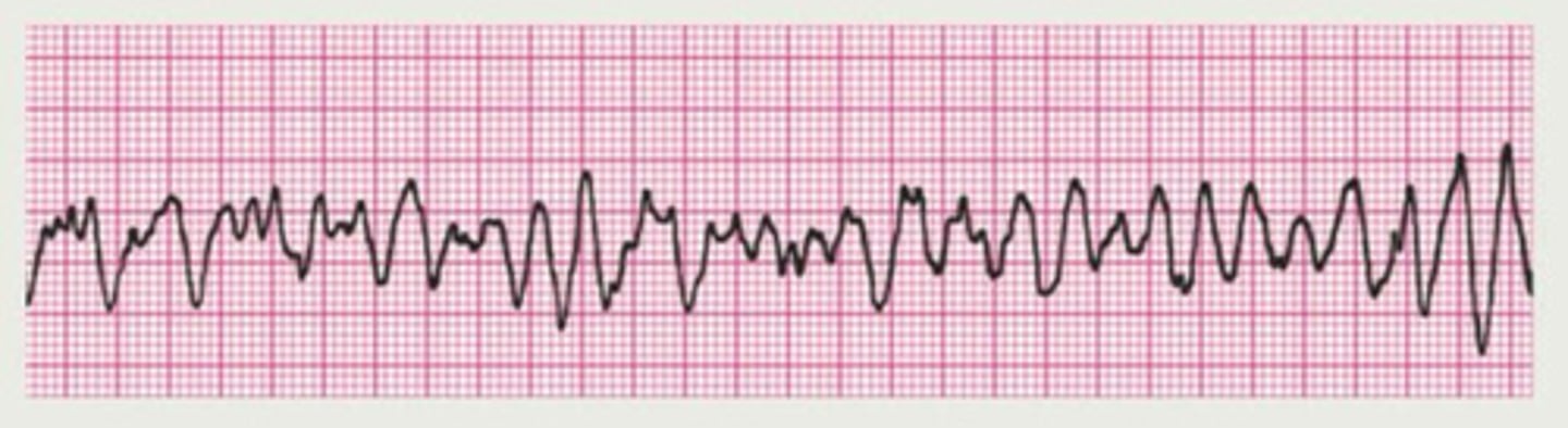 <p>Is this shockable?</p>