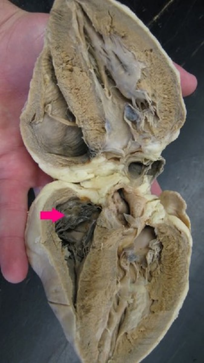 <p>Identify the valve.</p>