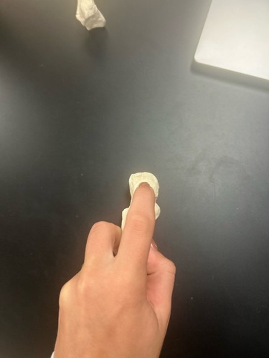 <p>name the bone</p>