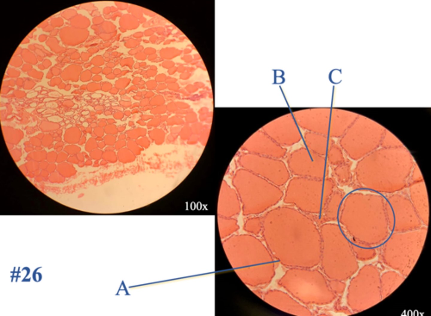 <p>Name the cell at A</p>