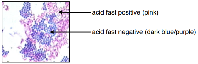 <ul><li><p><strong>Cell Wall</strong>: Thick peptidoglycan layer covered with <strong>mycolic acids</strong> (waxy lipid layer)</p></li><li><p><strong>Outer Membrane</strong>: Absent, but has a waxy lipid layer that provides protection</p></li><li><p><strong>Staining</strong>:</p><ul><li><p>Does <strong>not</strong> stain well with Gram stain</p></li><li><p>Requires <strong>Ziehl-Neelsen stain</strong> (stains <strong>red</strong> with carbol fuchsin)</p></li></ul></li><li><p><strong>Peptidoglycan Layer</strong>: Thick but shielded by mycolic acids</p></li><li><p><strong>Teichoic Acids</strong>: Absent</p></li><li><p><strong>Lipid Content</strong>: <strong>Very high</strong> (due to mycolic acids)</p></li><li><p><strong>Periplasmic Space</strong>: Present</p></li><li><p><strong>Endotoxin (LPS - Lipopolysaccharide)</strong>: Absent</p></li><li><p><strong>Antibiotic Resistance</strong>:</p><ul><li><p><strong>Highly resistant</strong> due to waxy cell wall</p></li><li><p>Resistant to many antibiotics, disinfectants, and immune defenses</p></li></ul></li><li><p><strong>Example Bacteria</strong>: <em>Mycobacterium tuberculosis, Mycobacterium leprae</em></p></li></ul><p></p>