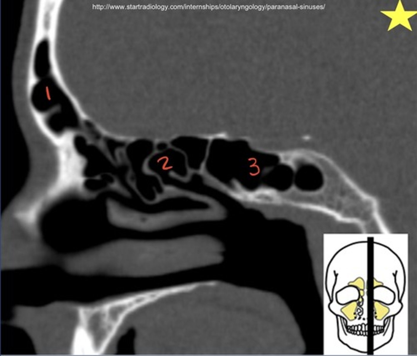 <p>In this sagittal CT of the normal sinuses, identify 1-3 respectively.</p>