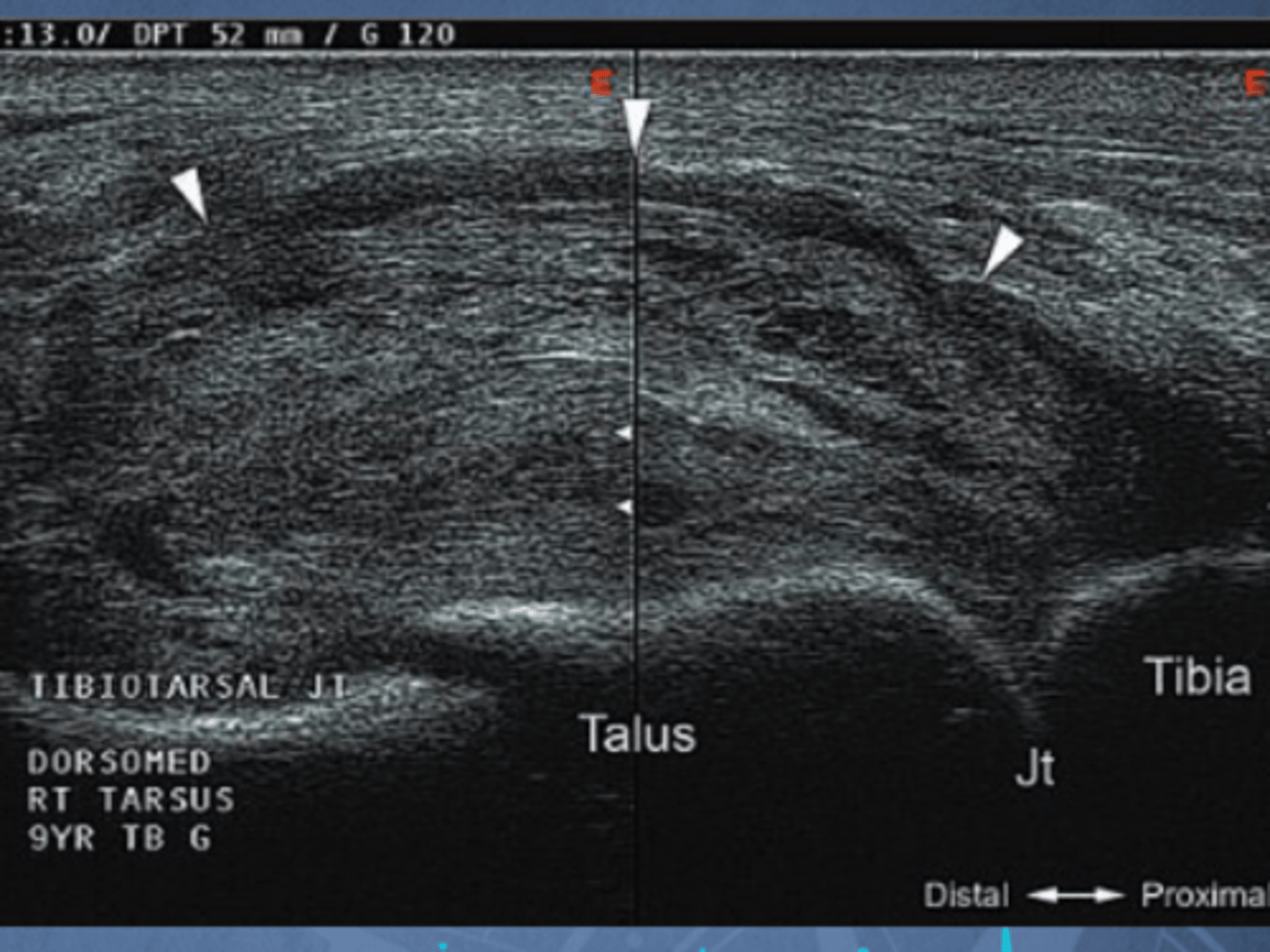 <p>What is the u/s identifying?</p>