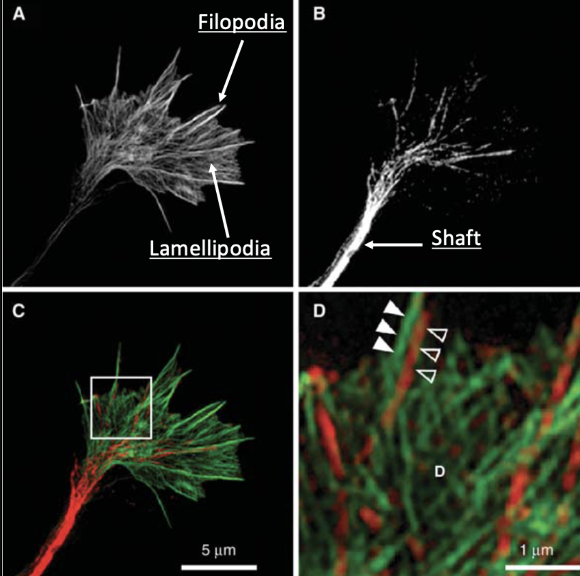<p>axon= end of the neuron, which sends the message out towards other neurons</p><p>sprouting= where new axons grow</p><p>==&gt; <strong><u>happens during ***fetal development but can also happen ***as a result of injury,</u></strong> and it <strong><u>would be ***driven by engagement in activity</u></strong></p><ul><li><p><strong><u>***new growth from growth cone</u></strong> (which probes the environment in search of a target) – <strong><u>***developing axons</u></strong></p><ul><li><p>growth cone is the navigator of the axon-“fan shaped” distal tip of the axon that<strong> <u>***probes the environment</u></strong> by extending and retracting membranous projections called filopodia (finger-like projections of bundled actin) &amp; lamelliopodia (sheet-like projections formed by a meshwork of actin)</p></li><li><p>axon outgrowth and guidance to targets depend on the coordination of cytoskeletal proteins (actin and microtubules) and environmental guidance cues</p><ul><li><p><strong><u>***protrusion</u></strong>: <strong><u>***extension of new membrane at the edges of the growth cone</u></strong></p></li><li><p><strong><u>***engorgement</u></strong>: <strong><u>***microtubule-driven transport of organelles and vesicles ***into the peripheral regions</u></strong></p></li><li><p><strong><u>***consolidation</u></strong>: <strong><u>***stabilization of the proximal portion growth cone ***into a cylindrical axon shaft, ***creating the axon as it continues to grow</u></strong></p><p>==&gt; these <strong><u>***axon outgrowth stages</u></strong> ^^^ <strong><u>***occur in response to environmental cues</u></strong> (i.e., <em>factors in the environment that call out to the </em><strong><u>***</u><em><u>growth cone or </u></em><u>***</u><em><u>repel the growth cone</u></em></strong>)</p></li></ul></li></ul></li><li><p><strong><u>***collateral sprouting from healthy axons:</u></strong> <strong><u>***allow axons to make multiple connections with various targets</u></strong></p><ul><li><p>occurs during development and in response to injury/disease</p></li></ul></li></ul><p></p>