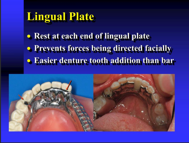 <p>describe lingual plate </p>