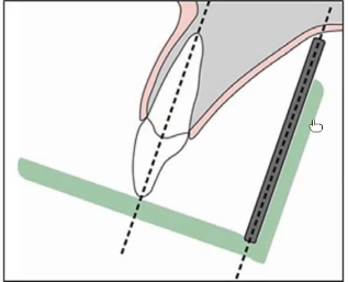 <ul><li><p>the receptor and long axis of the tooth should be parallel to each other</p></li><li><p>for parallel technique!</p></li></ul><p></p>