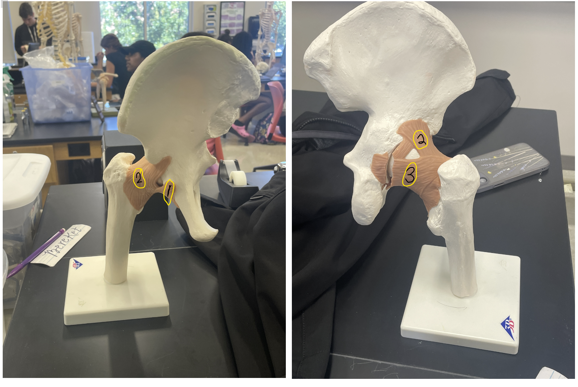 <p>what ligament is #1</p>