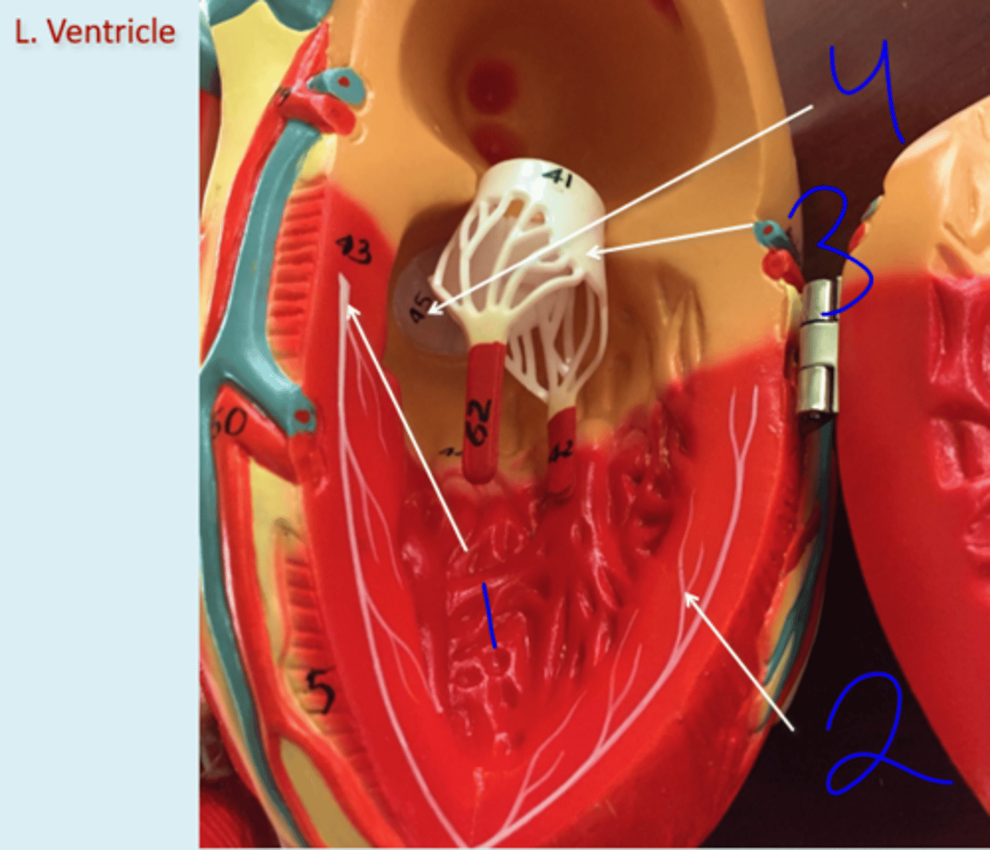 <p>Left Ventricle - #3</p>