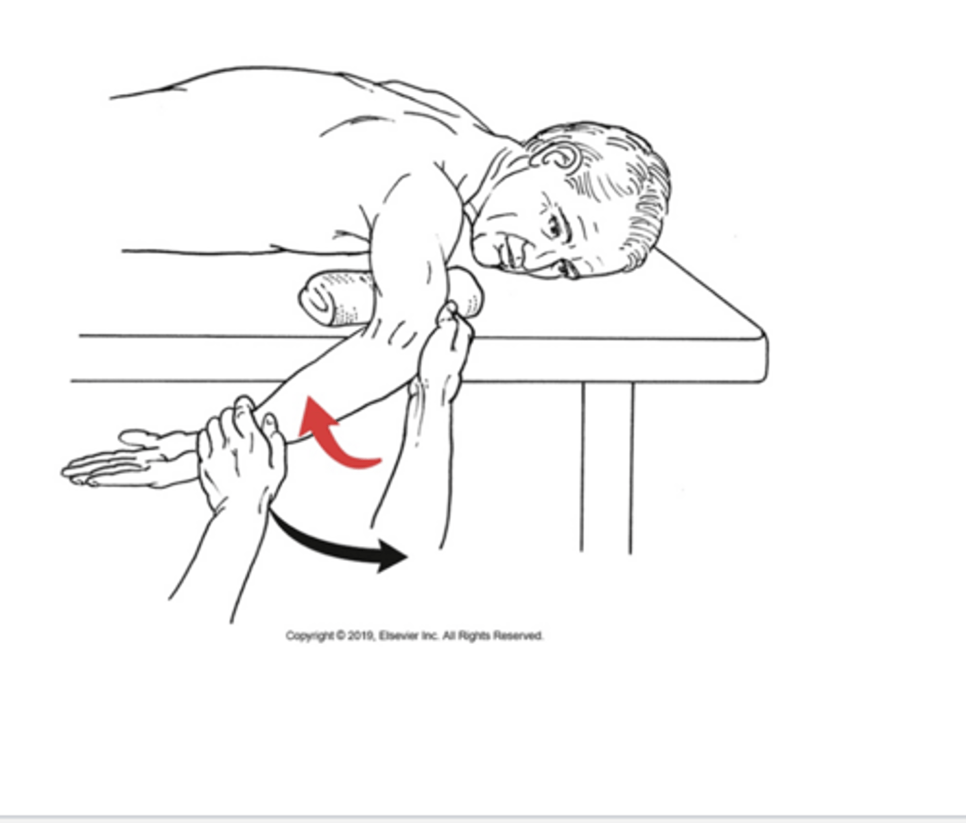 <p>Subscapularis; teres major, pectoralis major, latissum dorsi</p>