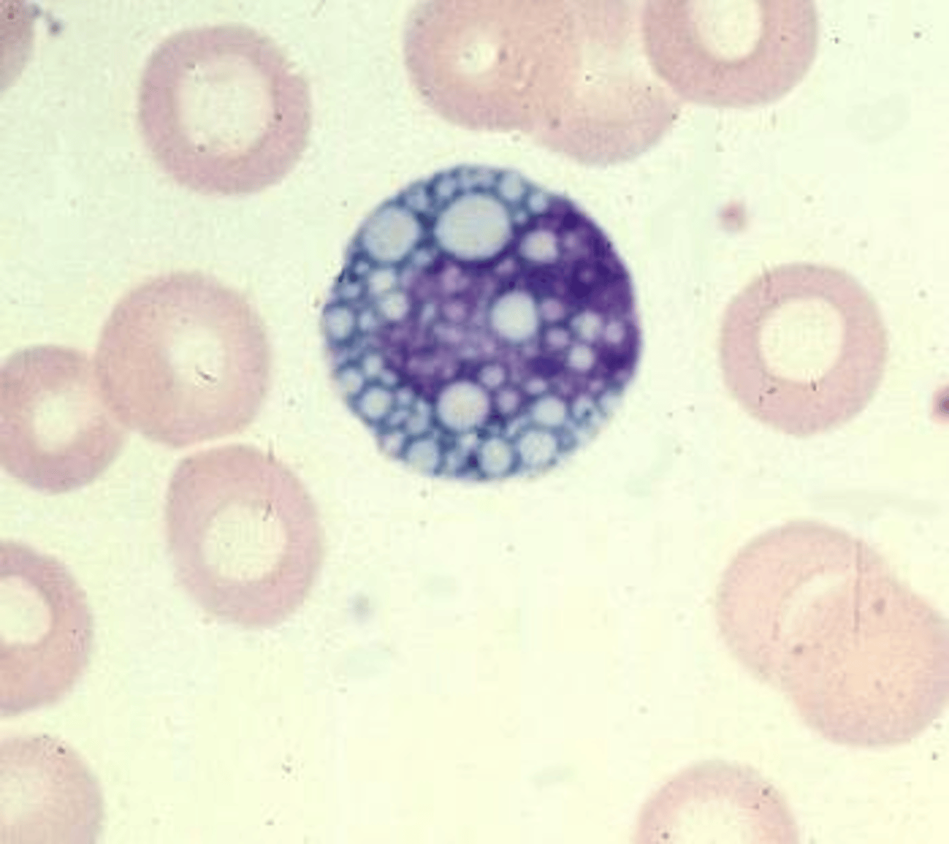 <p>What are the globular inclusions in this cell?</p>