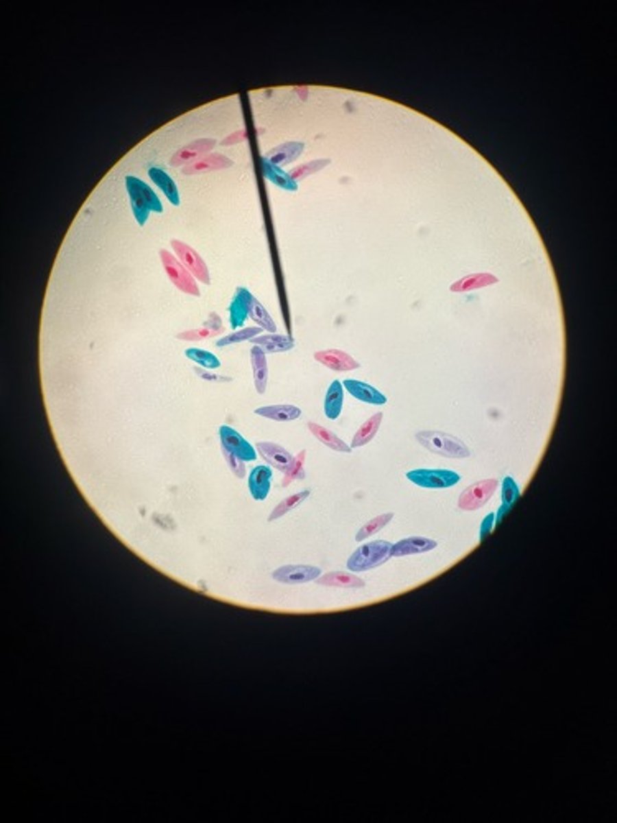 <p>Identify</p>