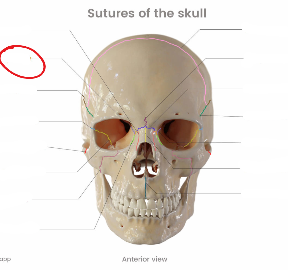term image