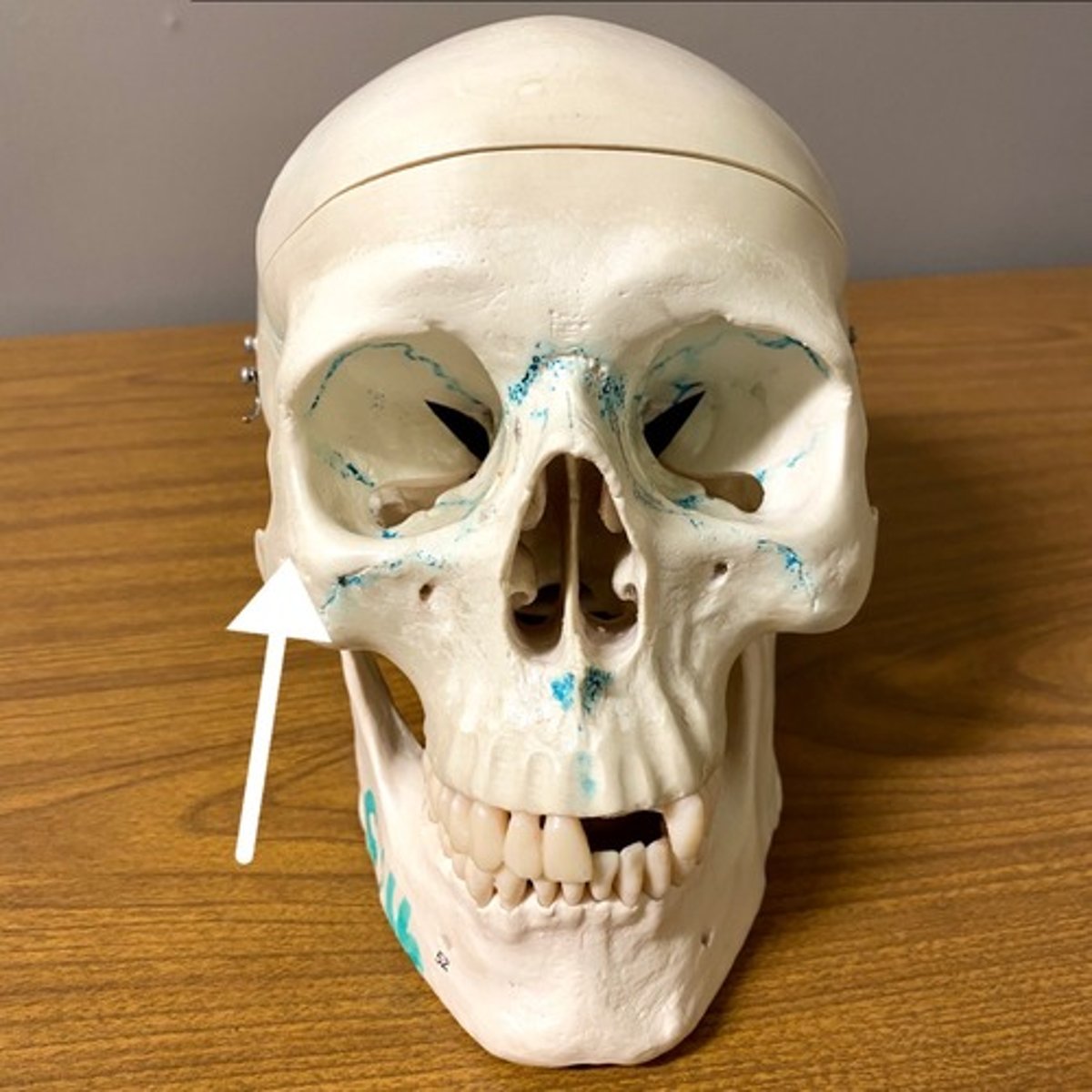<p>What bone is this?</p>