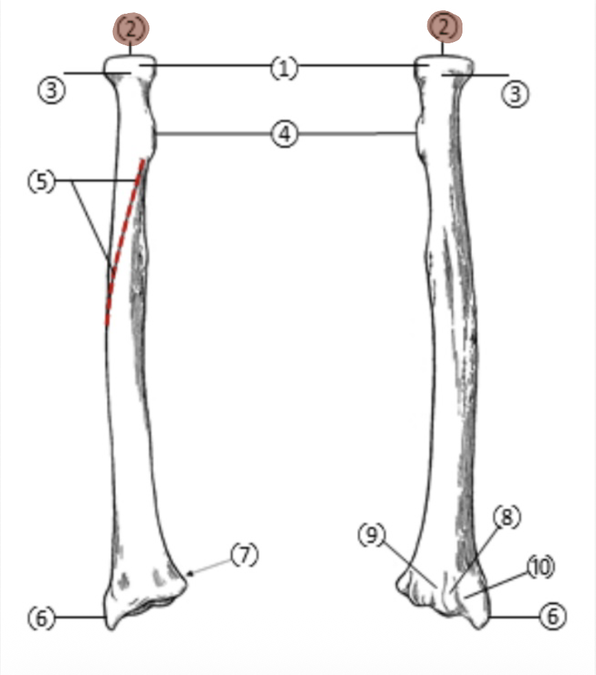 <p>On the Proximal end of the radius, which part is highlighted (2)?</p>