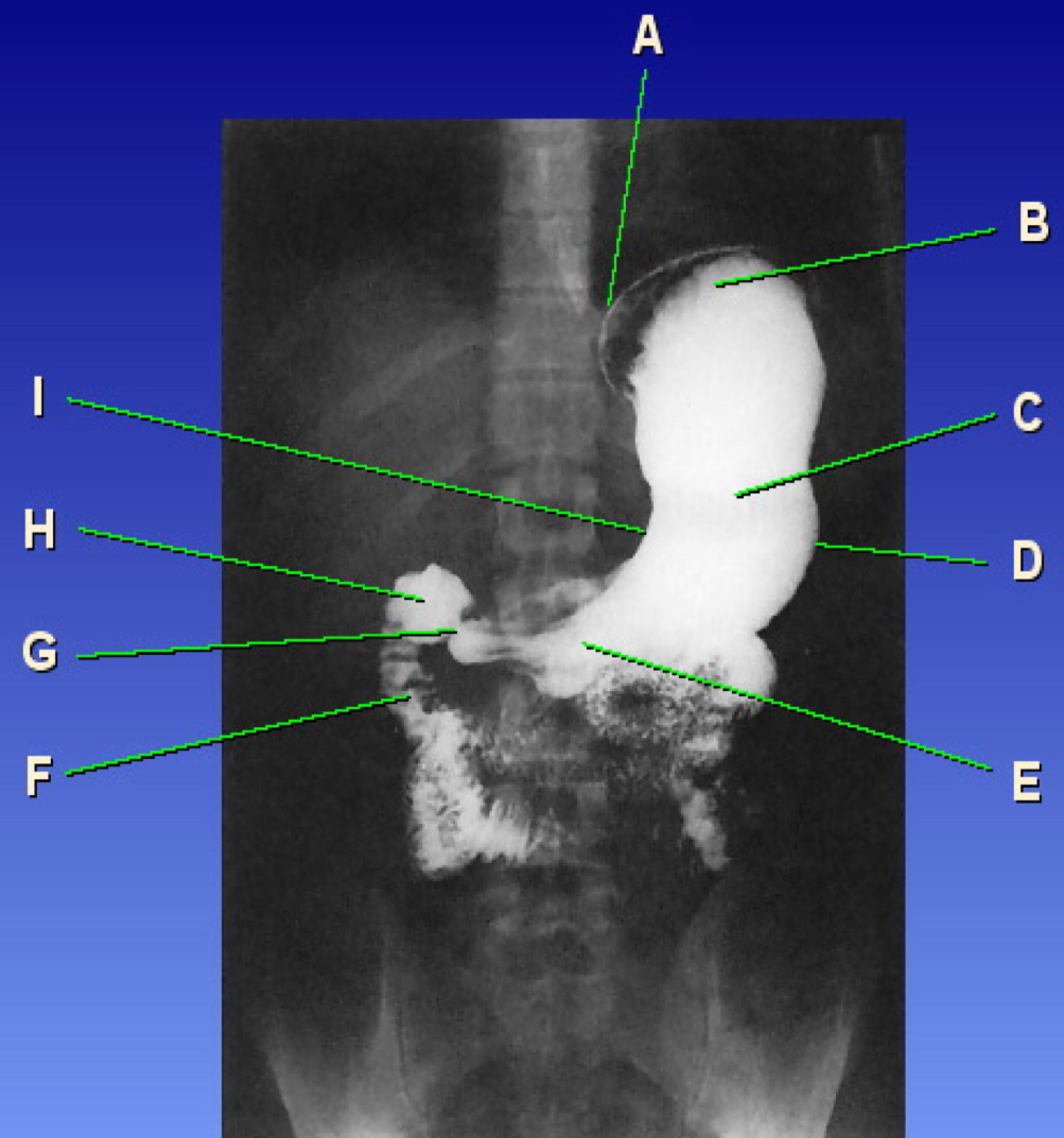 <p>What is B pointing to?</p>