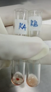 <p>Identify the:</p><ul><li><p>Blood Group</p></li><li><p>Antibody/Antibodies Present</p></li><li><p>Antigen(s) Present</p></li></ul><p></p><p>Grade the Reaction</p><ul><li><p>Known A1:</p></li><li><p>Known B:</p></li></ul><p></p>