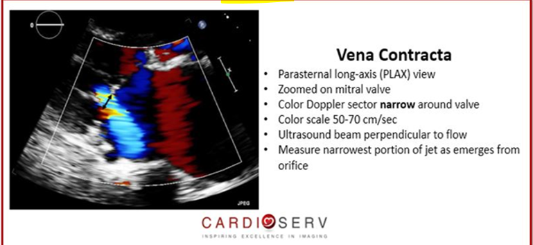 <p>narrowest portion of jet as it emerges from the orifice </p>