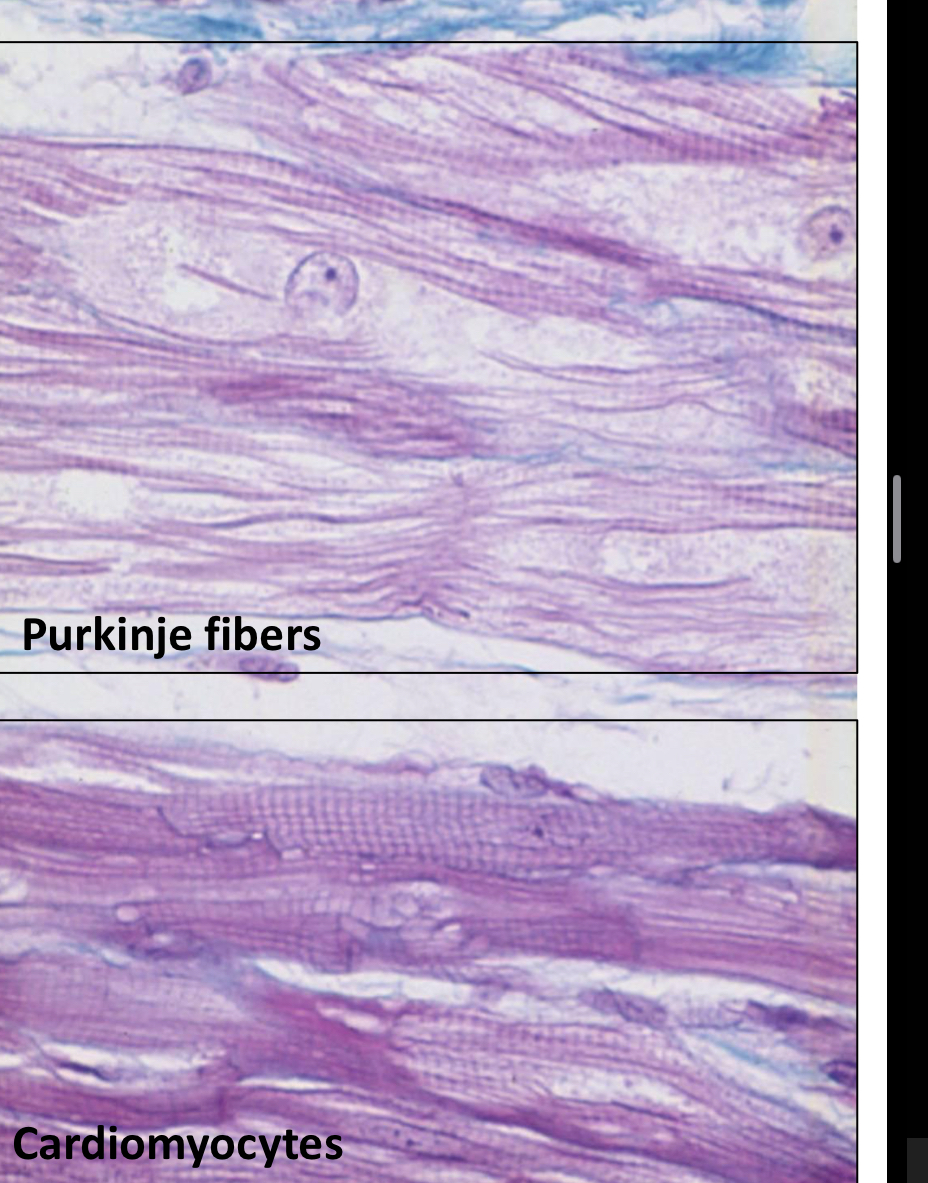 <p>What are the purkinje fibers?</p>