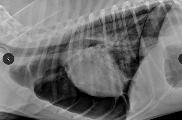 <p><span>Spontaneous Pneumothorax</span></p>