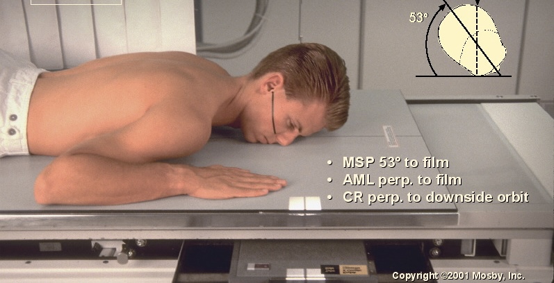 <p>What position is this?</p>
