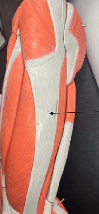 <p>what is this muscle?</p>