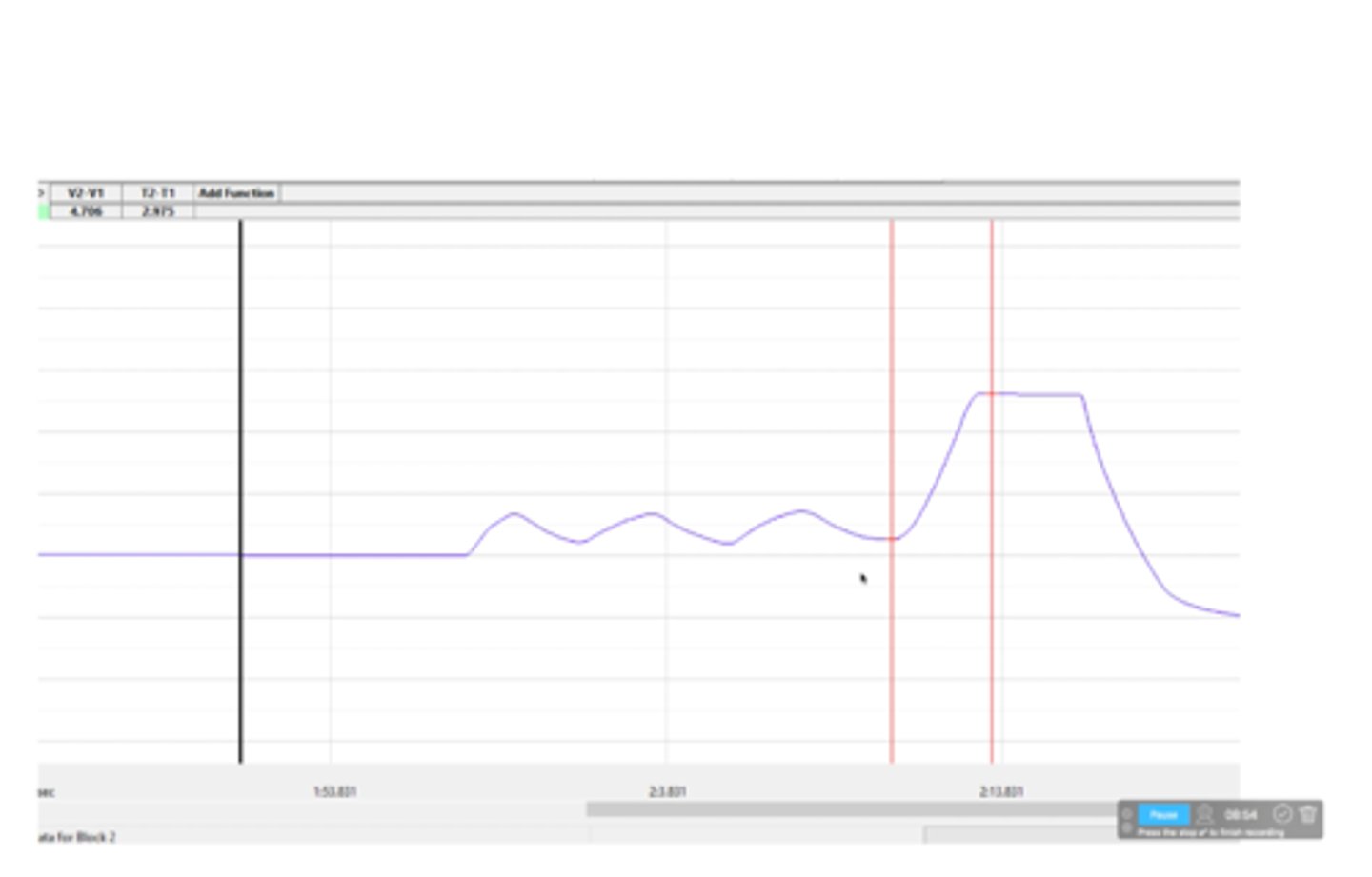 <p>What capacity is shown on this spirometer tracing?</p>