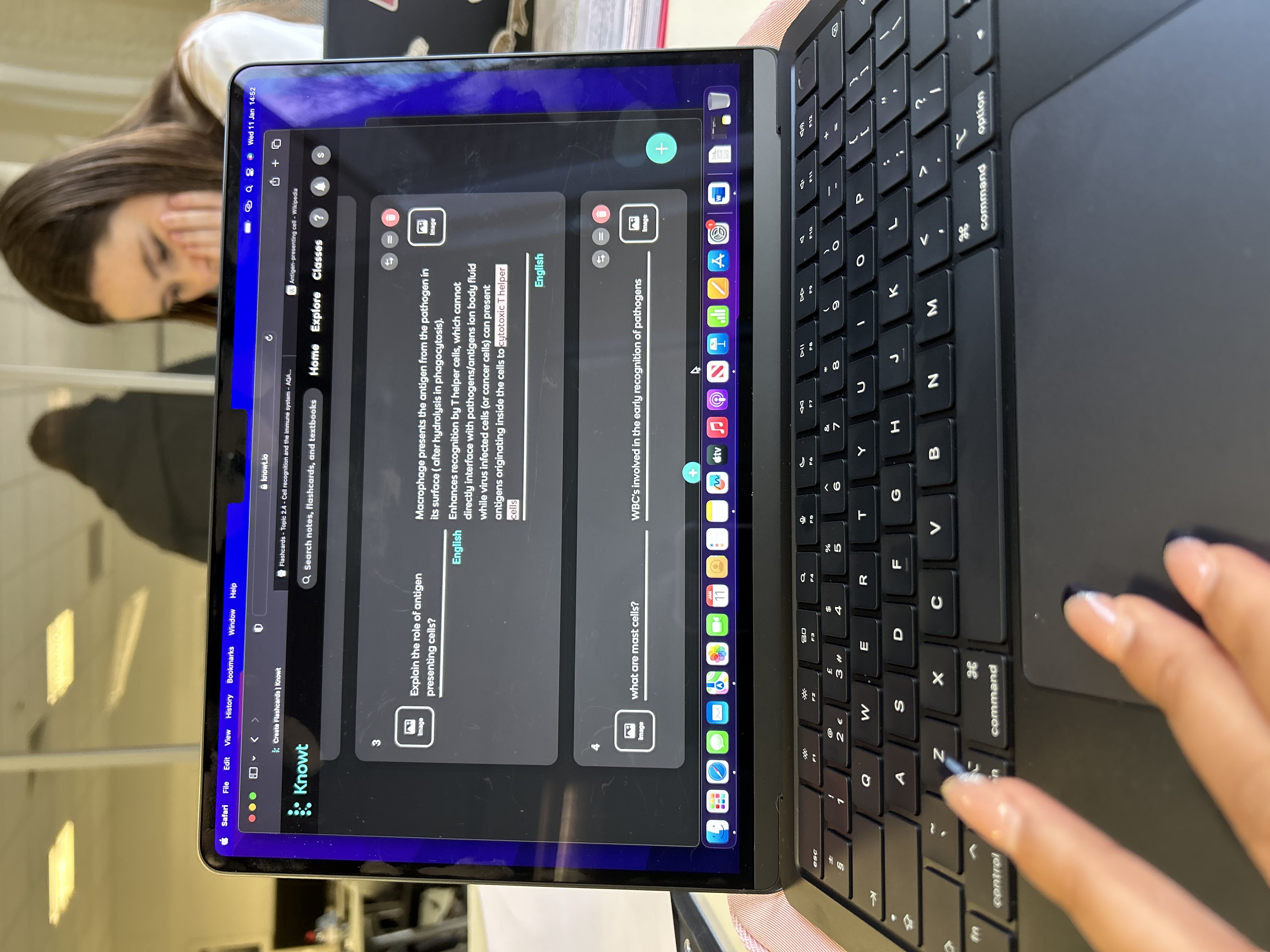 * cervical ( lordotic)
* thoracic (kyphotic)
* lumbar (lordotic)
* sacral (Kyphotic)