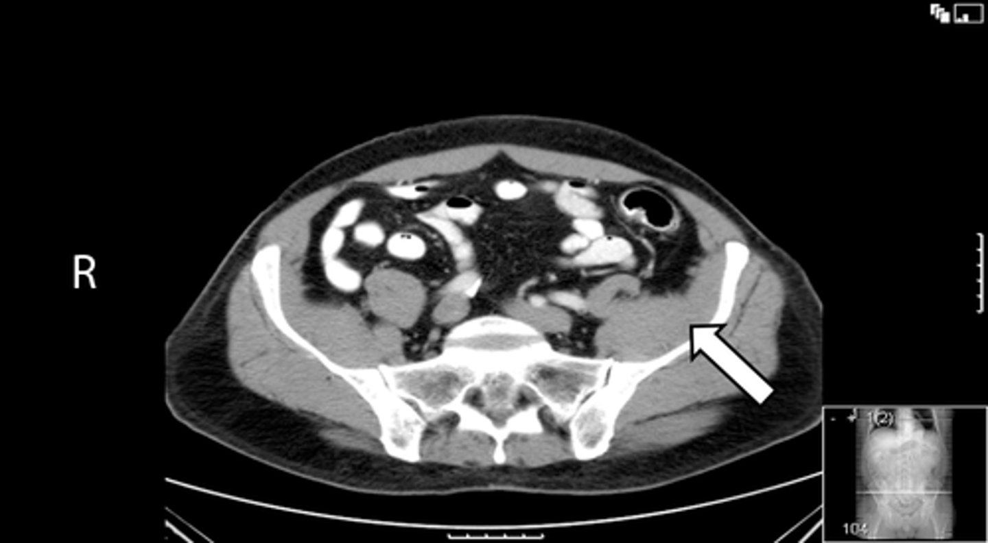 <p>What is indicated in the image?</p>