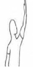 <p>Shoulder FLEX, ABD, ER</p><p>Forearm - Sup</p><p>Wrist - Rad. Flexion</p><p>Fingers - Extension</p>