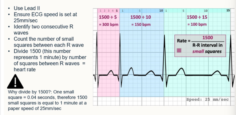 <ol><li><p>Lead II</p></li><li><p>25mm/sec</p></li><li><p>identify 2 consecutive R waves, count no. small squares between them, divide by 1500</p></li></ol><p></p>