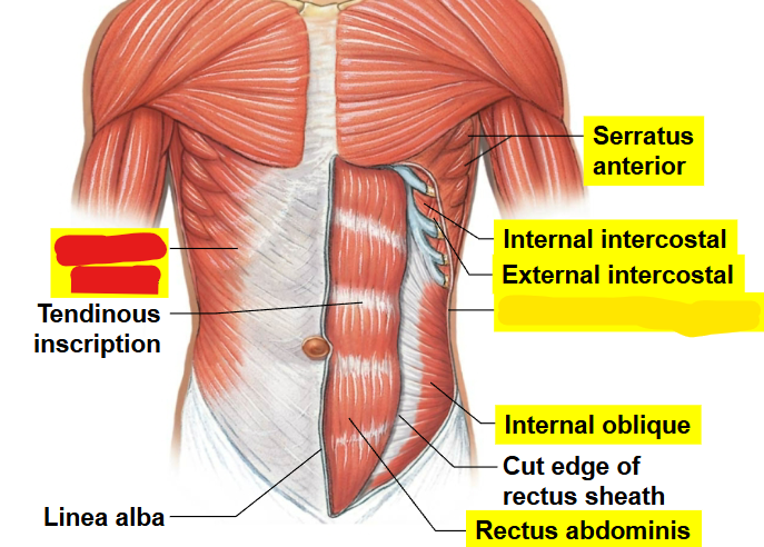 <p>What muscle is this?</p>