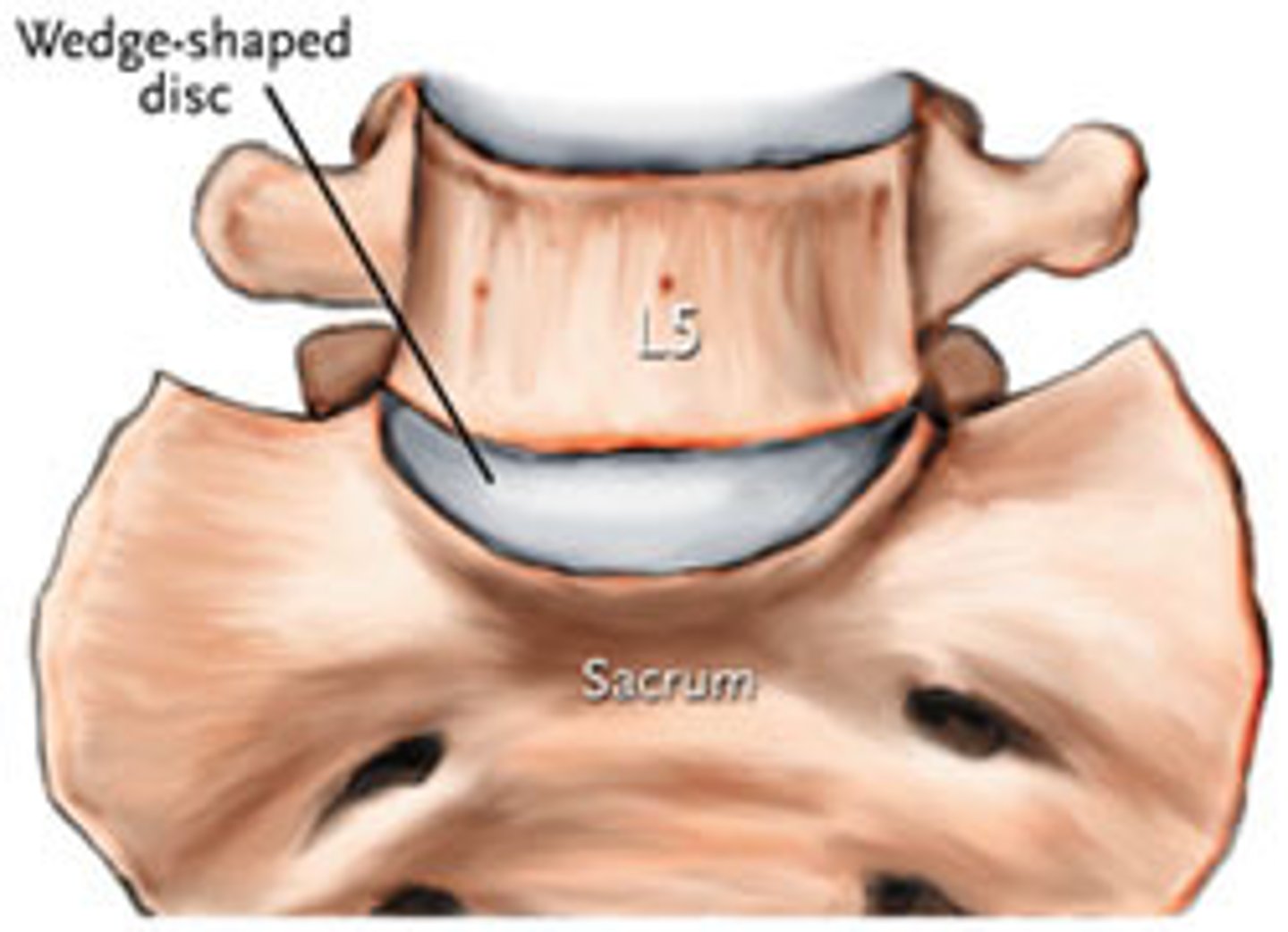 <p>Found between 5th lumbar vertebra and sacrum</p><p>Allows the pelvis to move relative to the trunk</p><p>- Weak joint</p><p>- Anterio IV joint is a symphysis </p><p>- Posterior facet joints are synovial plane joints </p>