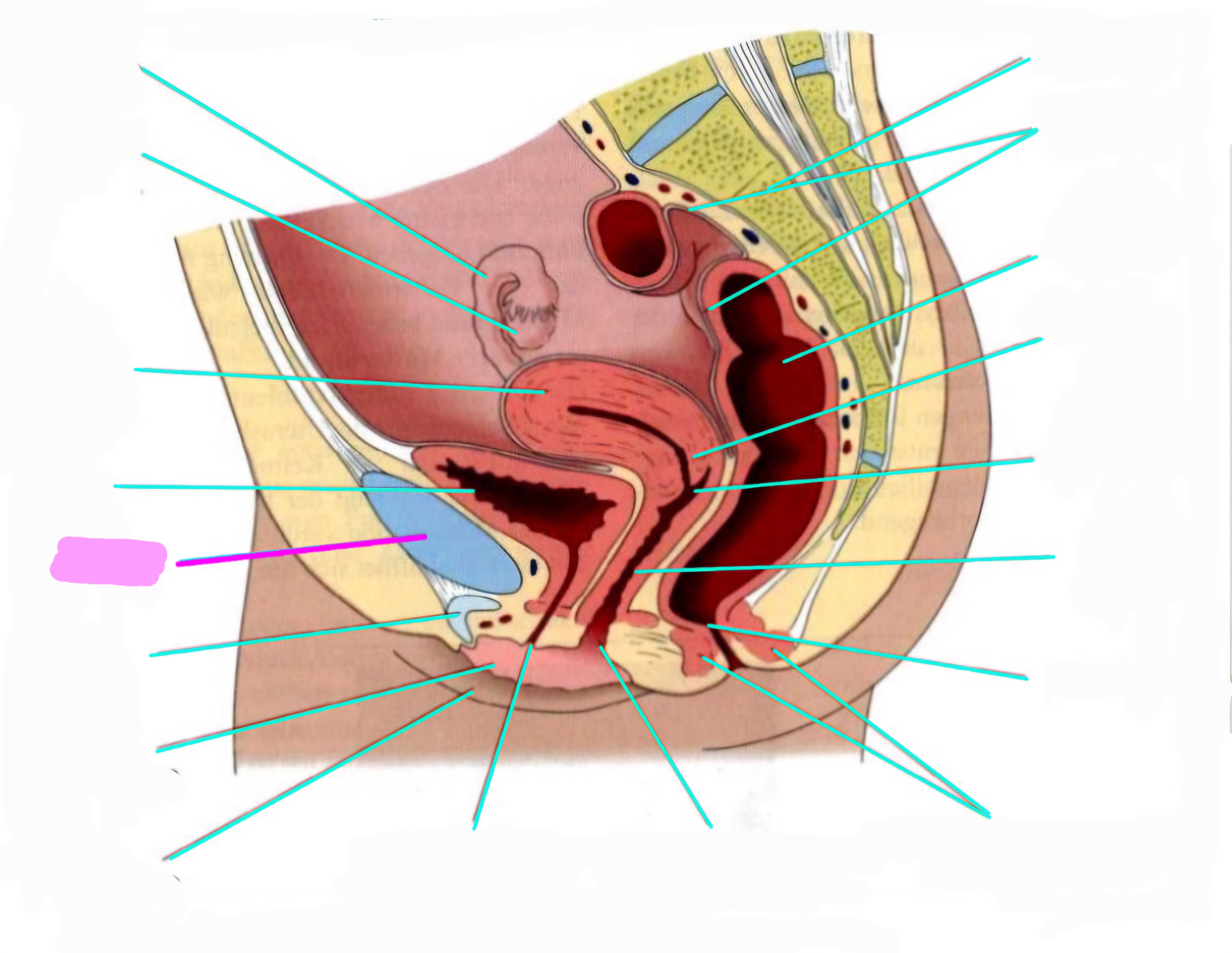 term image