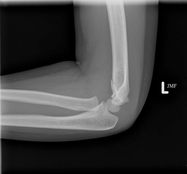 <p>Describe the abnormality demonstrated.</p>