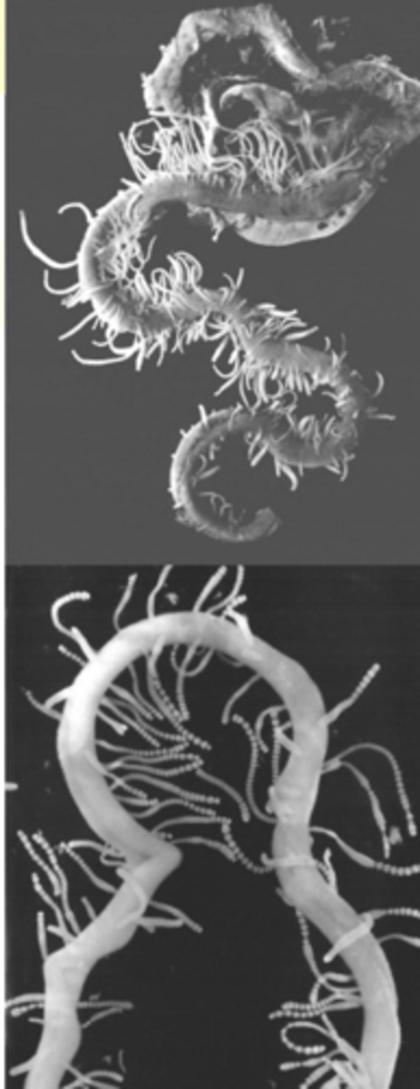 <p>• Necropsy</p><p>• Histopathology</p>
