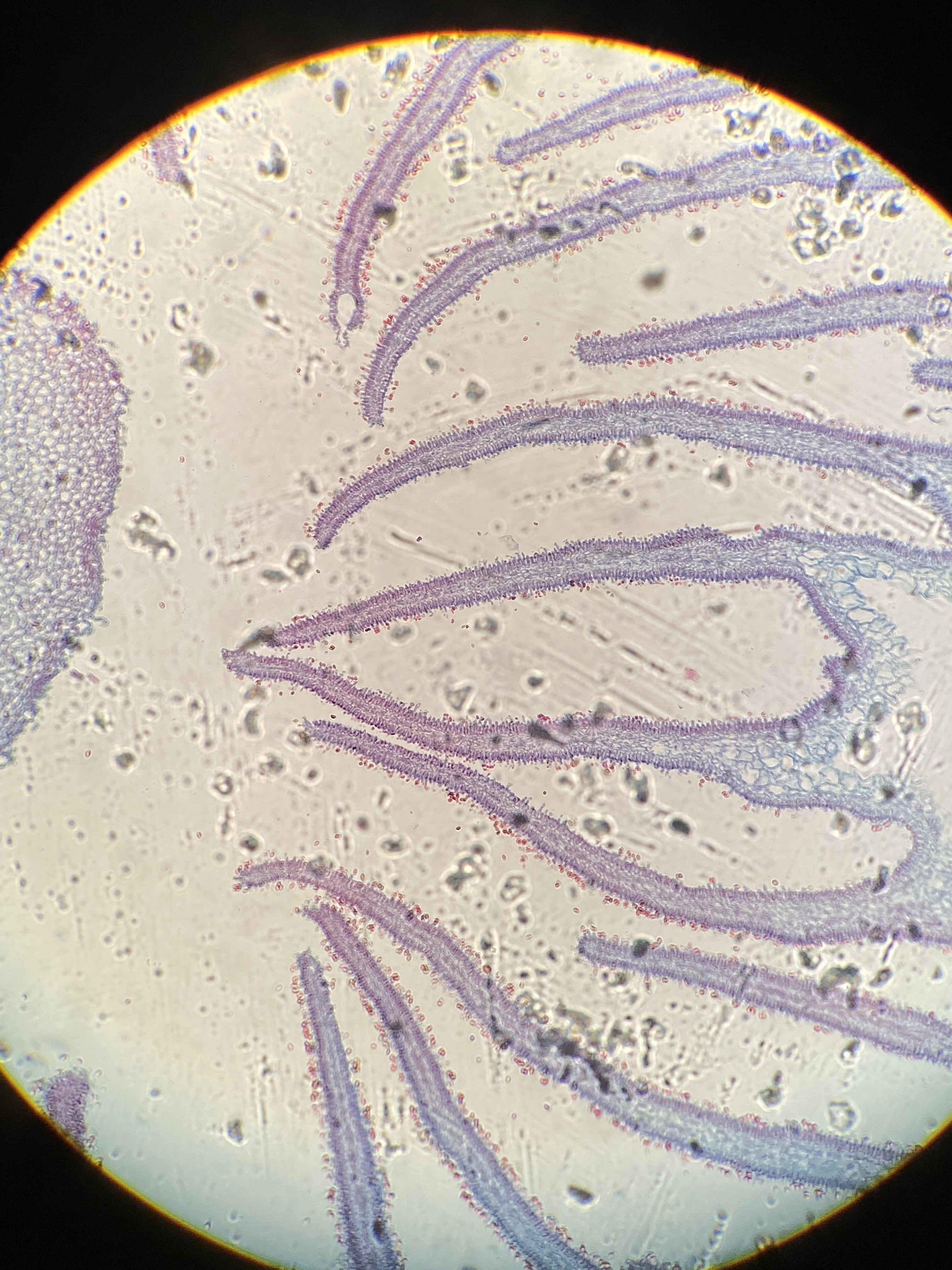 <p>bläcksvamp i tvärsnitt</p>