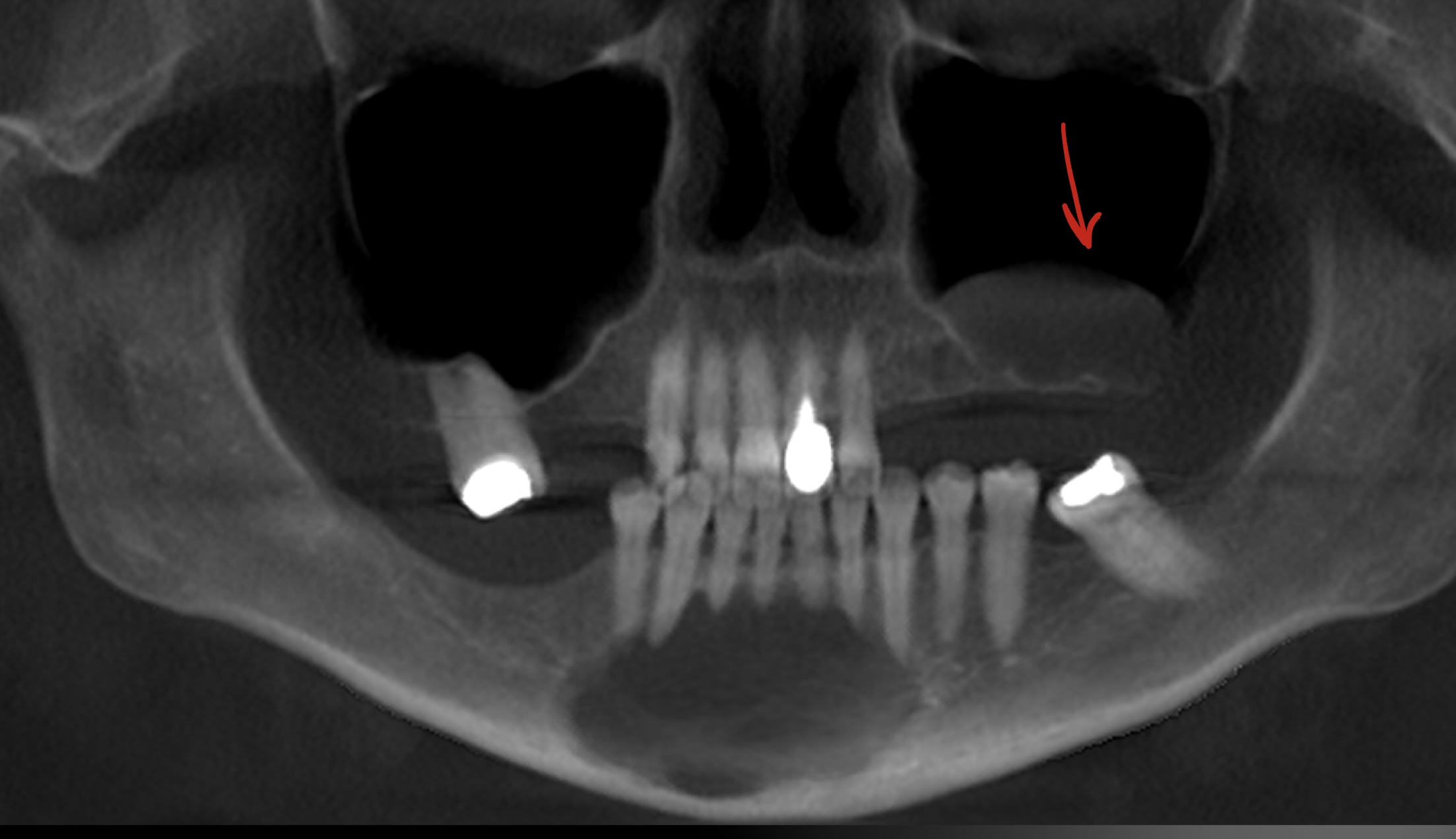 <p>Bonus what is the red arrow (list both)</p>