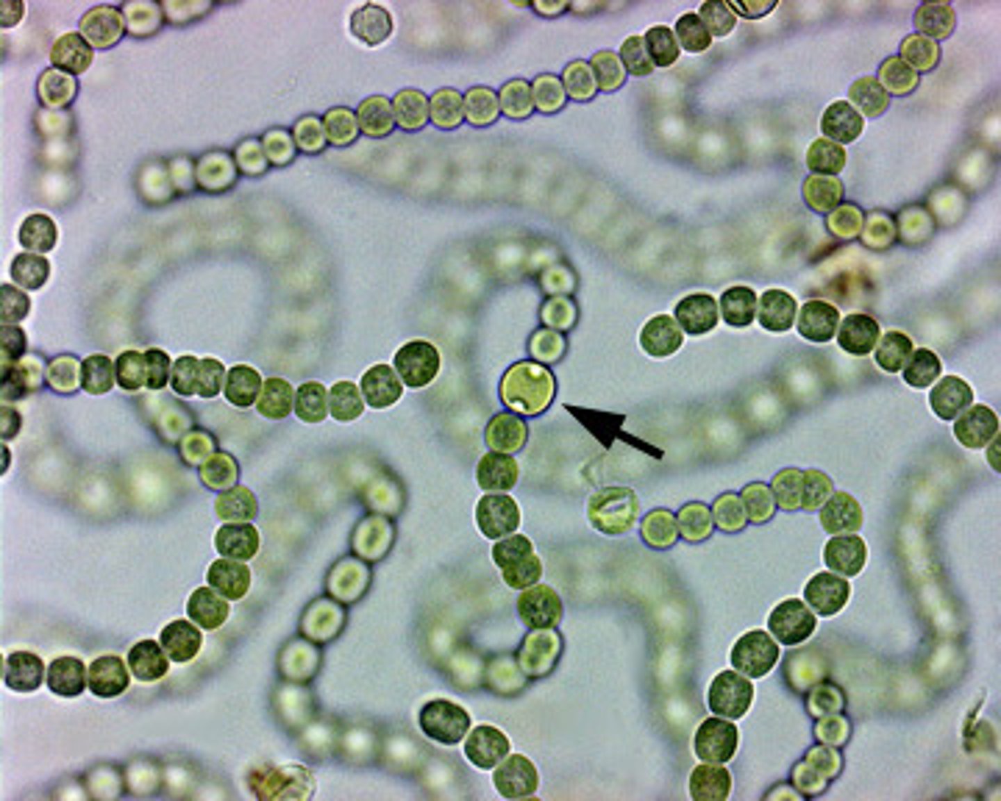 <p>this cyanobacteria forms grape-like macroscopic colonies that contain two types of cells</p>