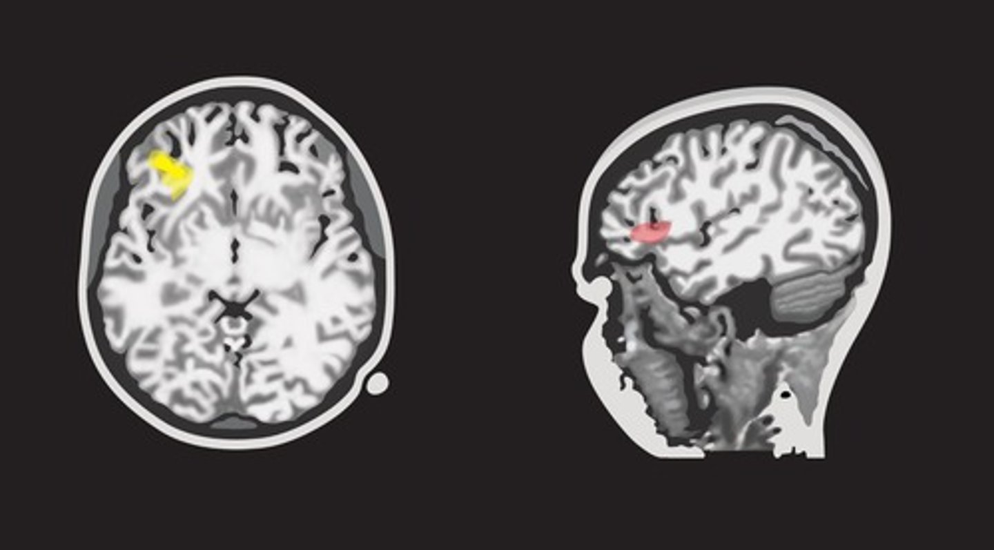 <p>Activity in the prefrontal cortex, temporal, and parietal lobes.</p>
