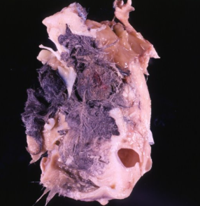 <p>What is this condition?</p>