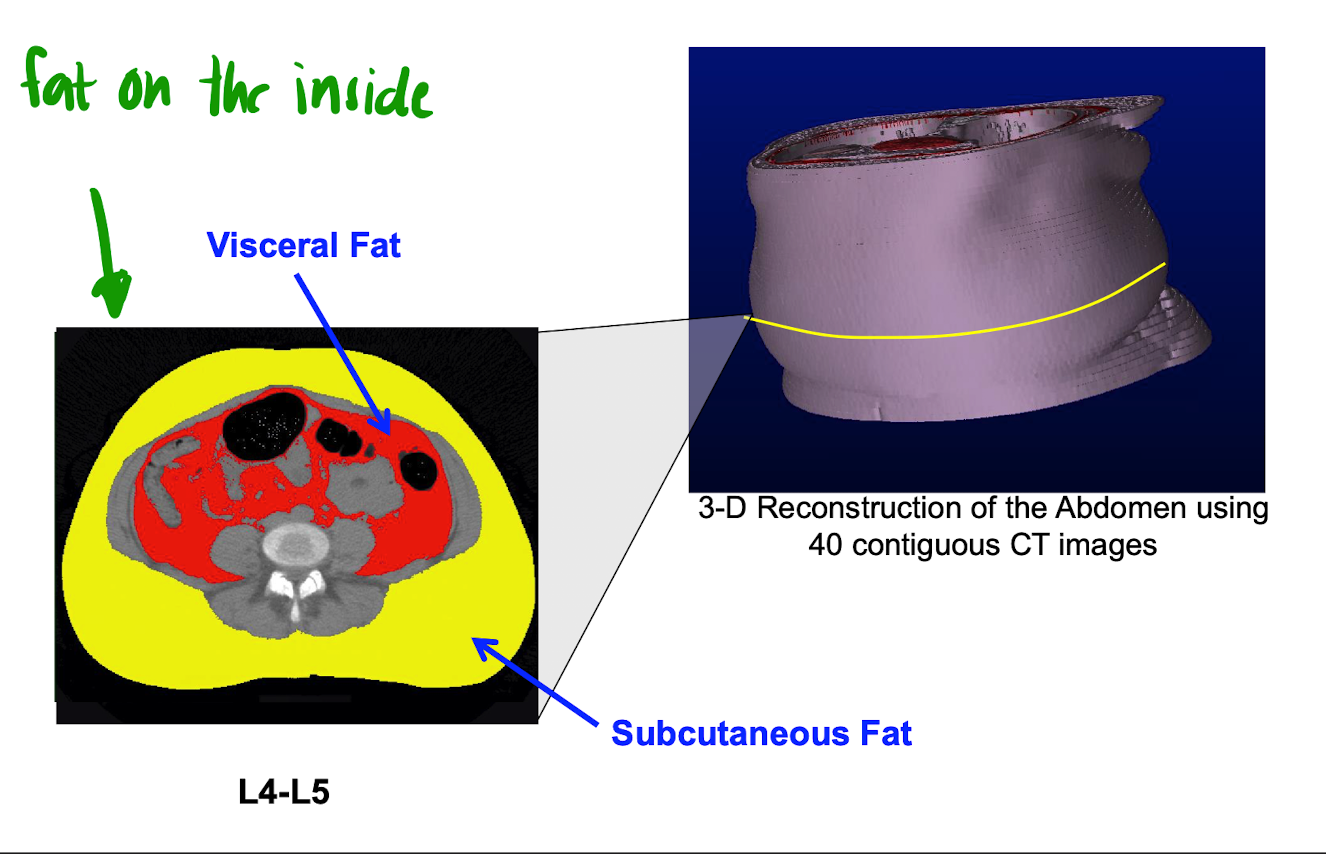 * visceral and subcutaneous 
  * not all fat is equal 